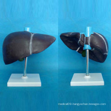 Human Liver Anatomy Model with Base for Medical Teaching (R100102)